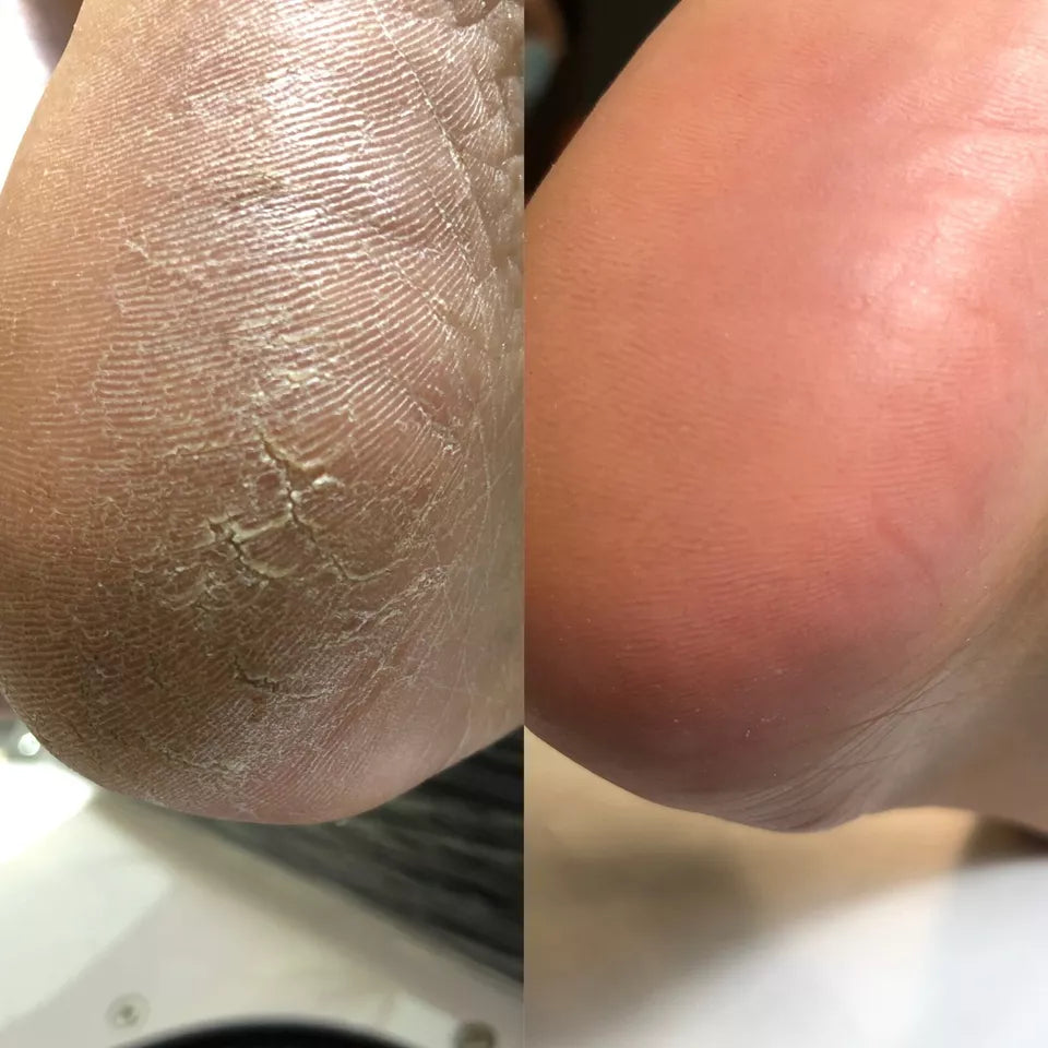 NAILSOFTHEDAY ONISTOP Regenerating Oil For Treatment Onycholysis