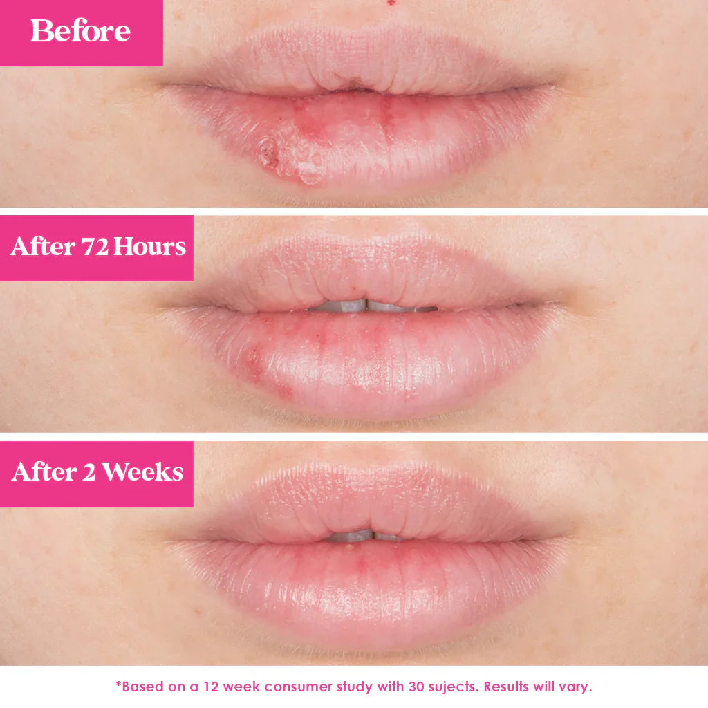 Grande POUT Plumping Lip Mask - Berry Mojito